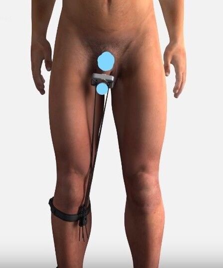 Member Increasing Device